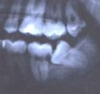 Radiografias