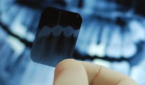 Radiografias